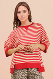 Sydney Oversized Stripe Casual Top
